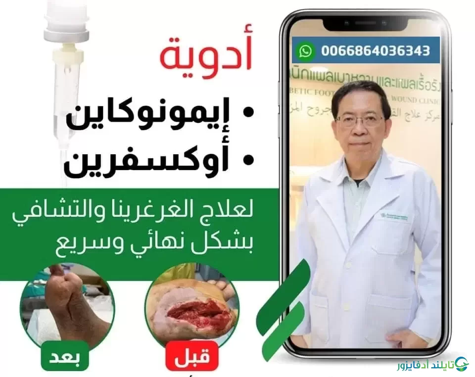 علاج القدم السكرية في تايلاند بدواء الإيمونوكاين والأوكسفرين