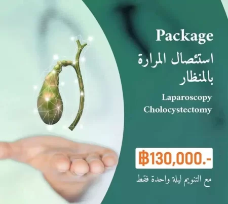 استئصال المرارة بالمنظار في تايلند بسعر يبدأ من 130 ألف بات 