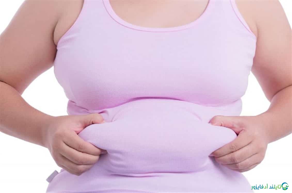شفط دهون البطن في تايلاند بافضل عيادات التجميل في بانكوك