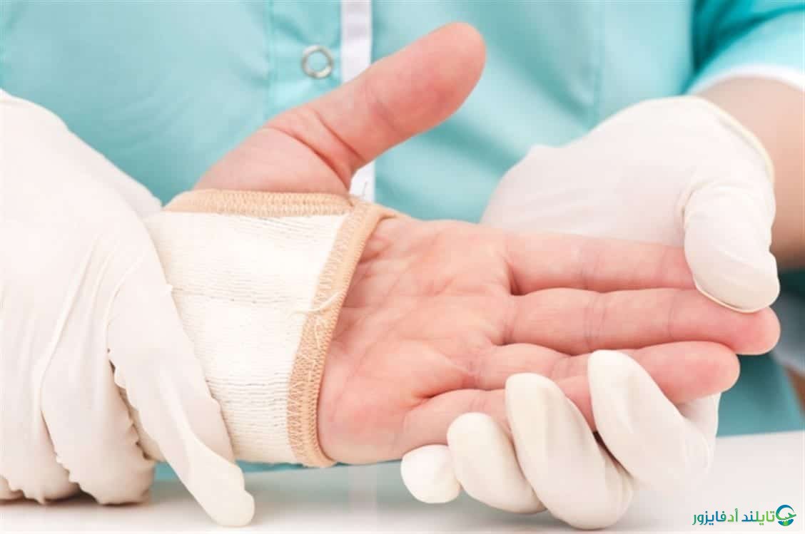 جراحة تجميل اليدين في تايلاند بافضل عيادات التجميل في بانكوك
